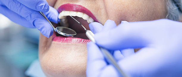 Best Emergency Dental Care for Abscessed Tooth in Garden City, NY